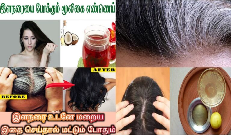 இளநரை பிரச்சனை தீர வேண்டுமா? இதோ உங்களுக்கான இய‌ற்கை வைத்தியம்!