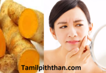 மாதவிடாய் காலத்தில் வரும் முகப்பருக்களை தடுக்க ஒரே ஒரு வழி! முகப்பருக்கள்