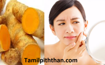 முகப்பருக்கள்